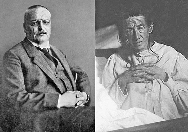 Alois Alzheimer and the Discovery of Alzheimer's Disease 1