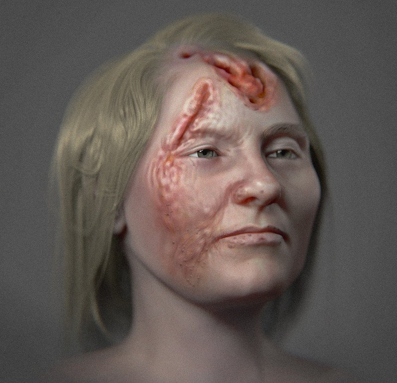 500 Years Ago The Face of a Woman with Syphilis Recreated 1