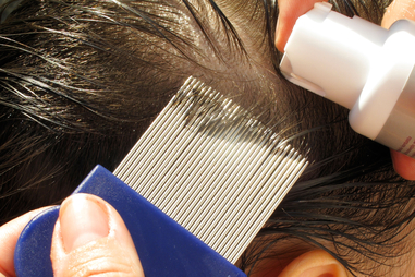 Head Lice Alert: What Parents Need to Know
